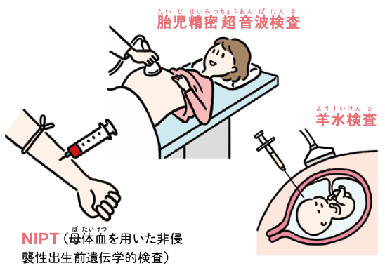 出生前検査