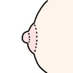 正常乳頭