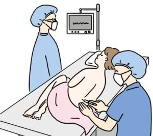 麻酔を受ける妊婦