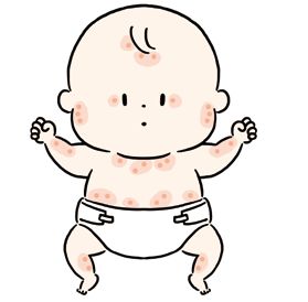 赤ちゃんのアレルギー